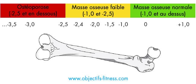 evaluation densite osseuse